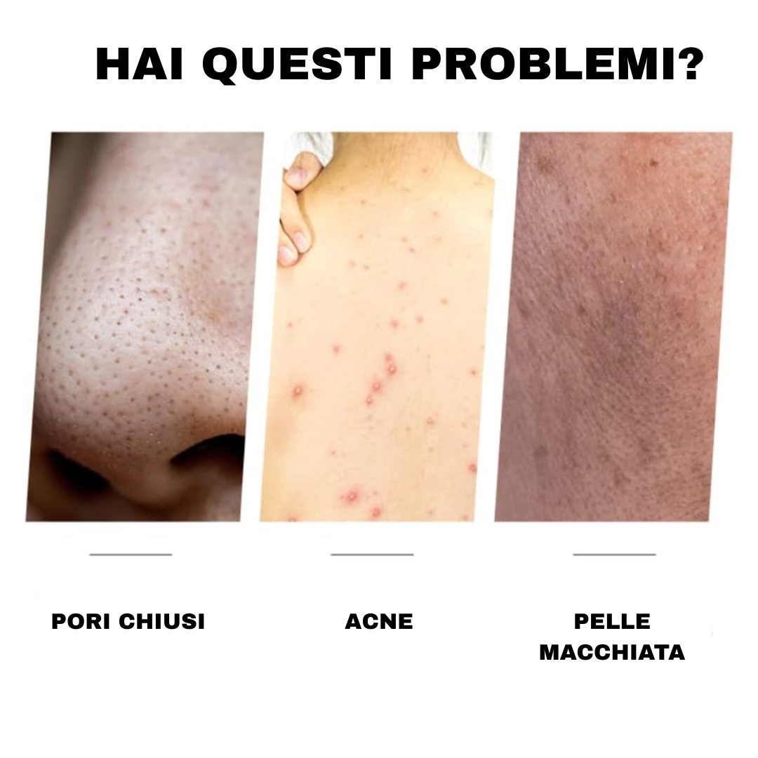 Sapone smacchiante