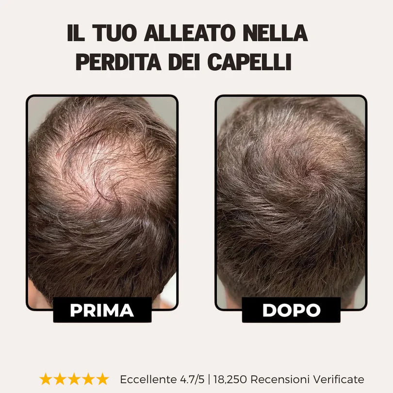 Shampoo Attivatore delle Radici