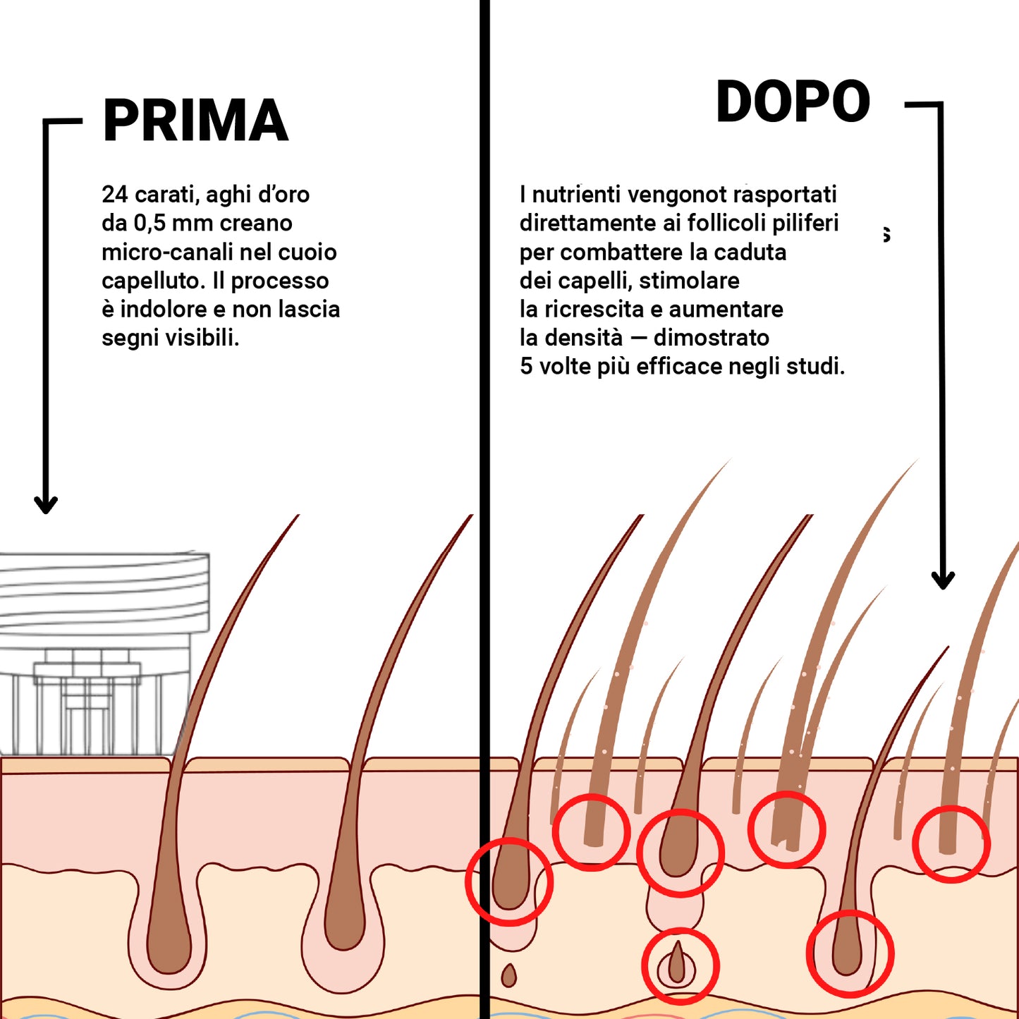 Alpha™ Ricrescita Capelli