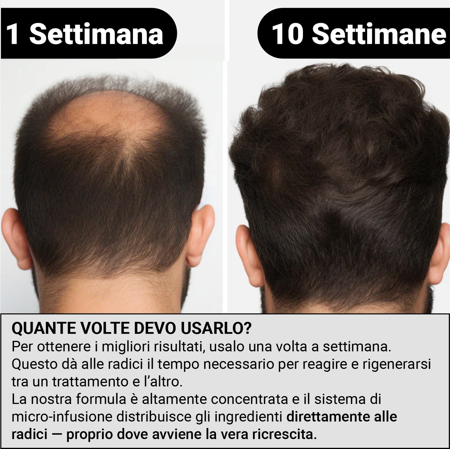 Alpha™ Ricrescita Capelli