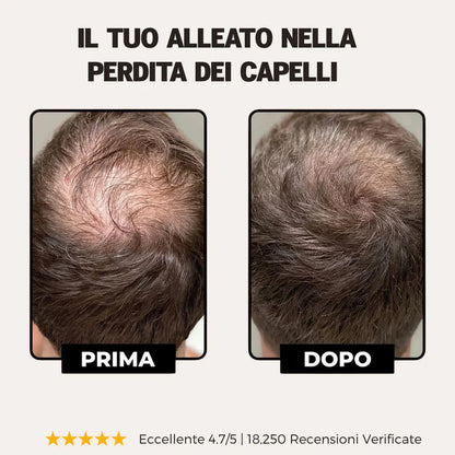 Shampoo Attivatore delle Radici