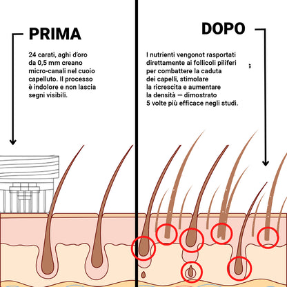Alpha™ Ricrescita Capelli