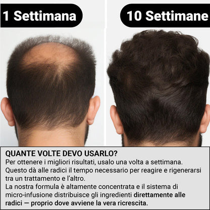Alpha™ Ricrescita Capelli